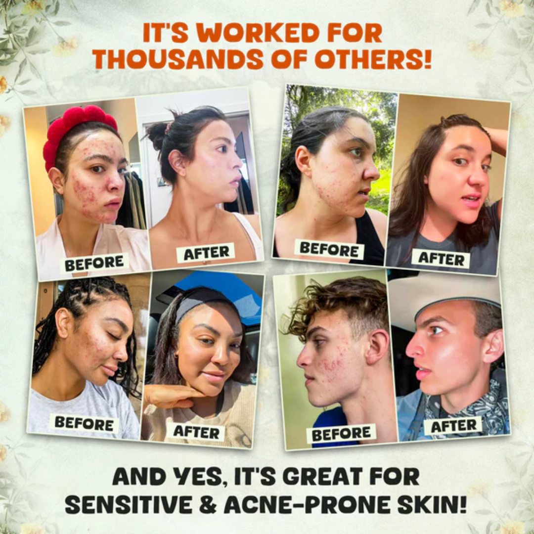 True Nourish's™ Purest Beef Tallow and Manuka Honey Balm