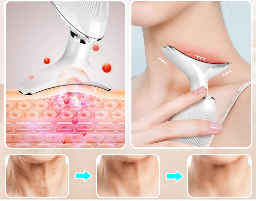 RadiantLift Pro: EMS Neck & Face Sculpting Device