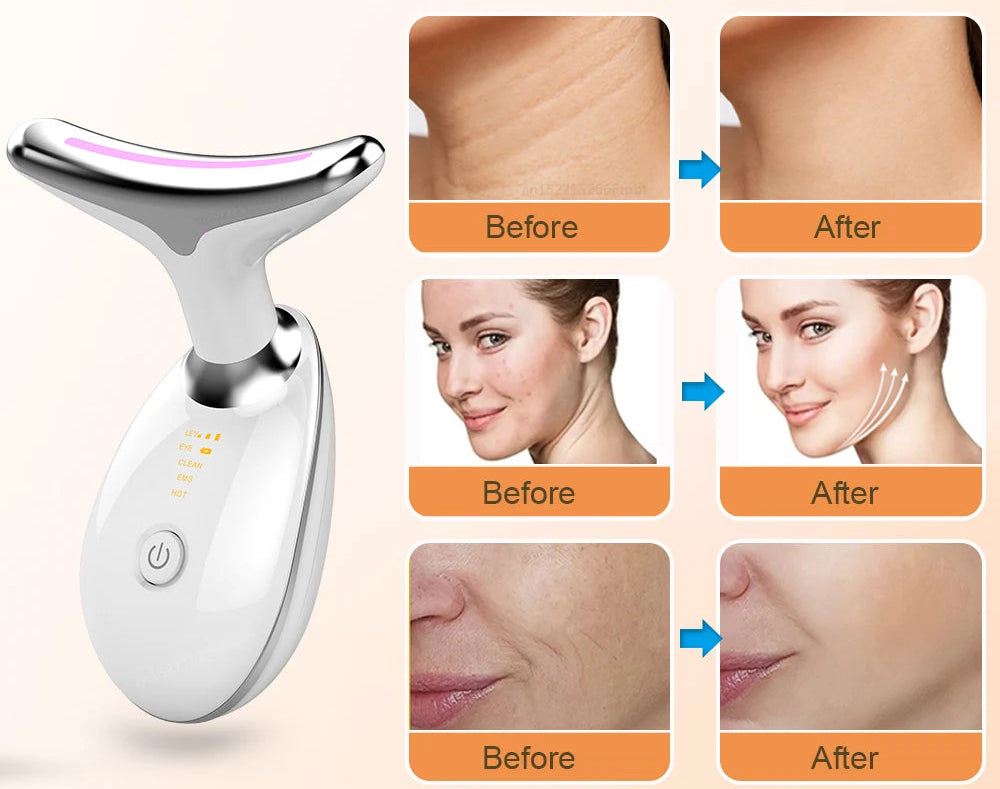 RadiantLift Pro: EMS Neck & Face Sculpting Device
